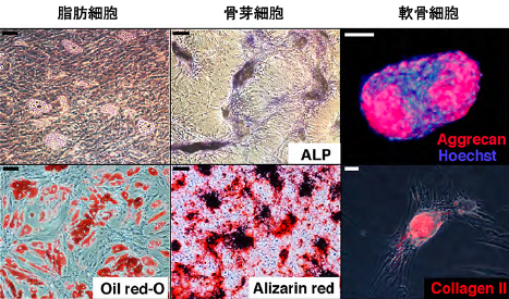DFATはクローンレベルで脂肪・骨・軟骨に分化する